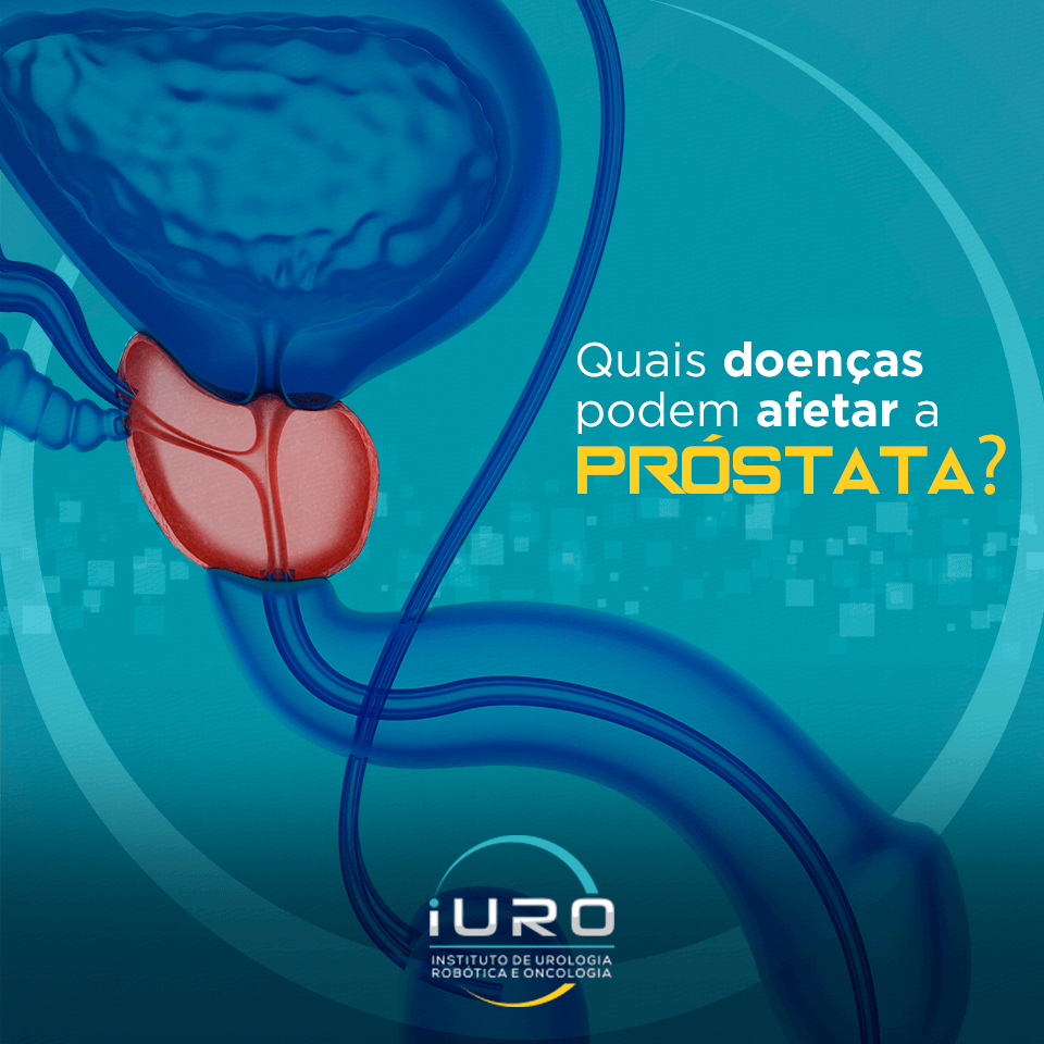 Quais doenças podem afetar a próstata? – iURO